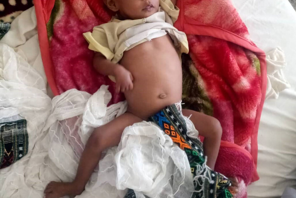 Antall alvorlig underernærte barn i Tigray-regionen bare vokser.