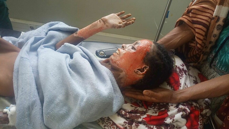 13 år gamle Kisanet Gebremicheal fra landsbyen Adi‘ayqoro i midtre Tigray har omfattende smertefulle brannskader over hele kroppen etter angrepet på hjemmet hennes 20. april i år. Et tungt våpen traff huset og det 'falt brann ned fra taket', forteller hun.