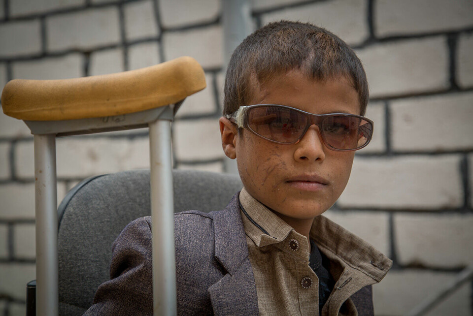 Musa fikk en alvorlig øyeskade etter et rakettangrep mot en skolebuss i Dahyan i Jemen i 2018. Bussen ble bombet av den saudi-ledede koalisjonen SLC. Om lag 50 mennesker ble drept, av dem var 40 barn. Foto: Mohammed Awadh/Save the Children.