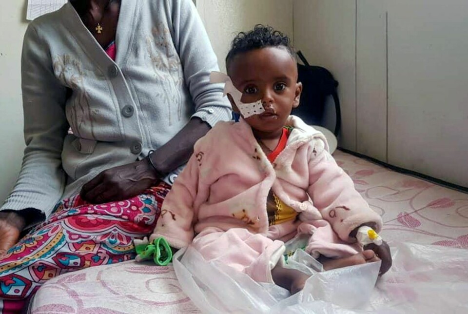 Ett år gamle Yordanos Mebrahtiu er ett av mange barn som behandles for underernæring ved Ayder-sykehuset i Mekelle. Som følge av krig og blokade er barnedødeligheten i Tigray-regionen firedoblet sammenlignet med hva den var før krigen. Bildet ble tatt 4. oktober.