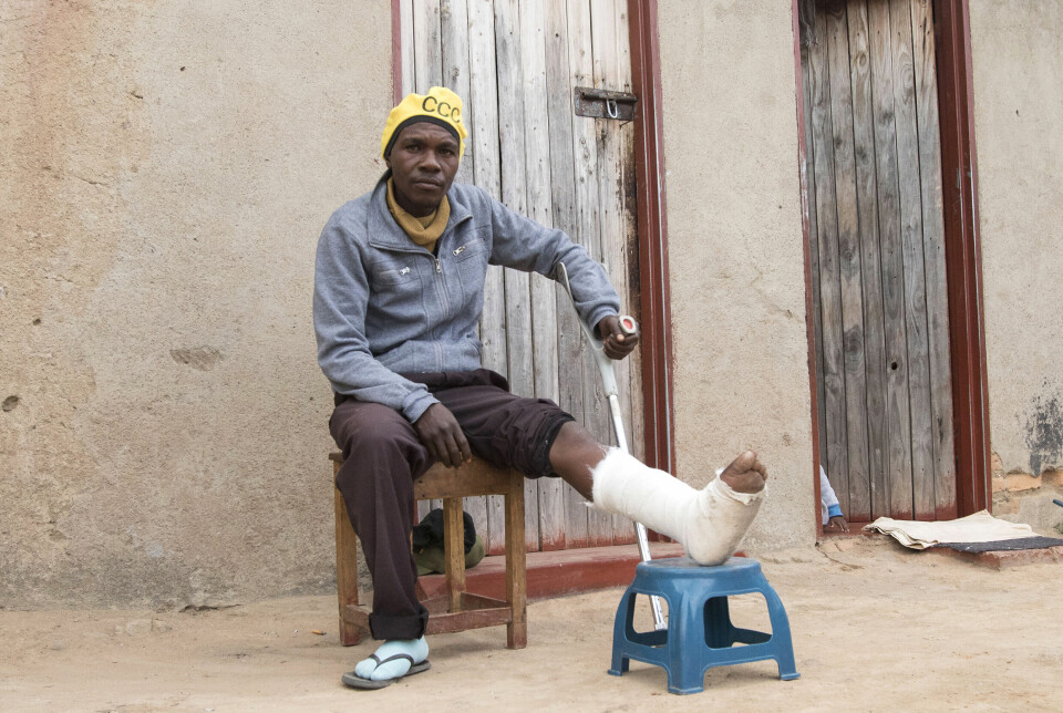 Batsirai Mazambara (33) fikk beinet brukket da en gruppe fra opposisjonspartiet CCC ble angrep av regjeringstilhengere på landsbygda i Zimbabwe.