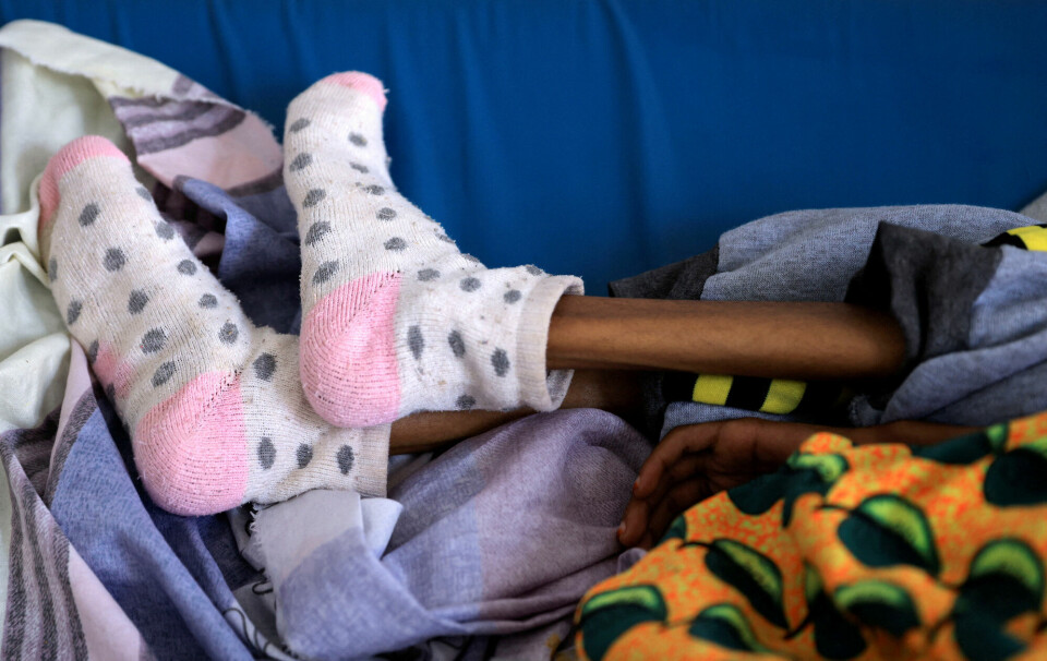I noen måneder slapp FNs matvarehjelp inn til Tigray. I mars i år var det imidlertid stopp, i seks måneder, etter at FN oppdaget omfattende korrupsjon i den etiopiske administrasjonen. Bildet viser beina til ei underernært ti år gammel jente på et sykehus i Tigray-regionen 22. juni i år.