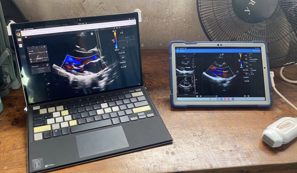En håndholdt ekkoenhet og ultralydsonde, (til høyre), ligger ved siden av den bærbare KI-enheten utviklet av Children's National Hospital i Washington.
