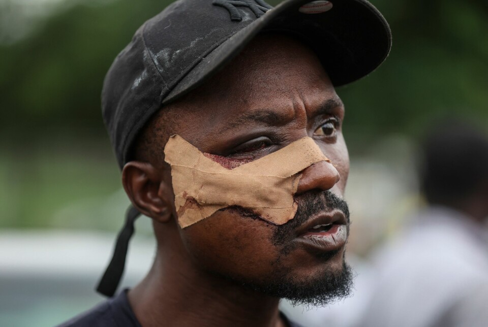 En skadet demonstrant etter sammenstøt med nigerianske sikkerhetsstyrker i Abuja, Nigeria, 1. august.