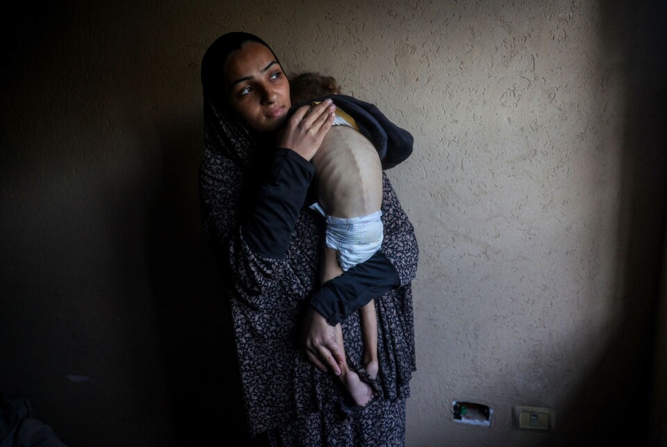 En palestinsk mor holder sin fem år gamle datter, som lider av underernæring, i Deir el-Balah på Gazastripen julaften 2024.