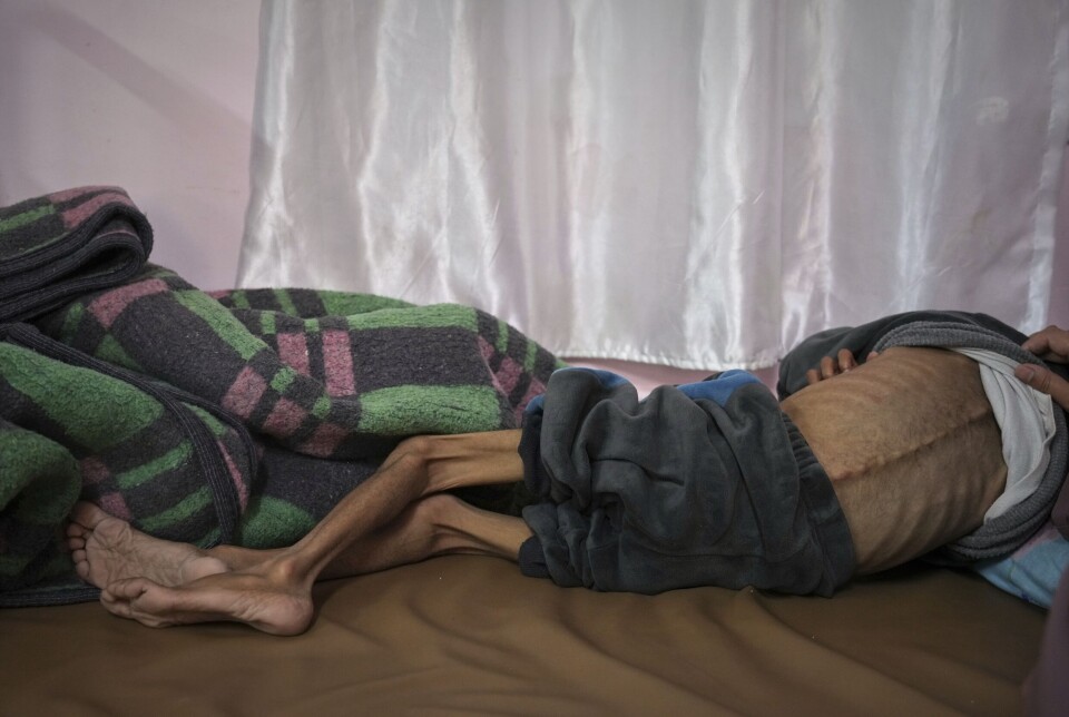 Osama al-Raqab (5) lider av cystisk fibrose og er alvorlig underernært. Her behandles han på en klinikk ved Nasser-sykehuset i Khan Younis i begynnelsen av mai.