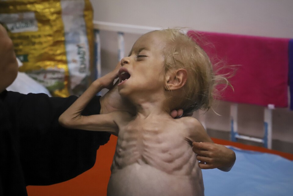 Israel er blant annet blitt anklaget for å bruke sult som våpen i krigen, og i august ble det erklært hungersnød i Gaza by. Her holder Islam Qudeih sin alvorlig underernærte datter Shamm, som er to år gammel.