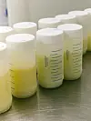 Flere flasker med morsmelk står på et metallbord, én med svakt grønnlig gul farge.